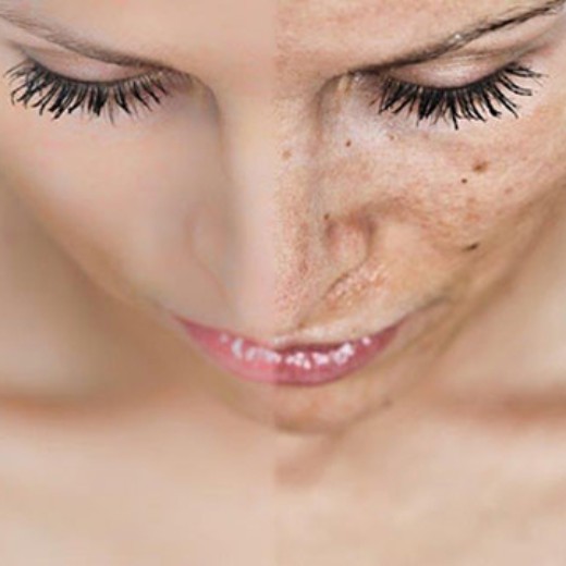 Hudproblemer (GRATIS konsultation)